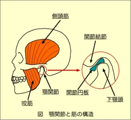 顎関節症図